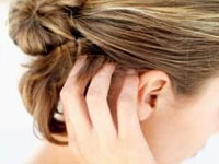 Dry Itchy Scalp